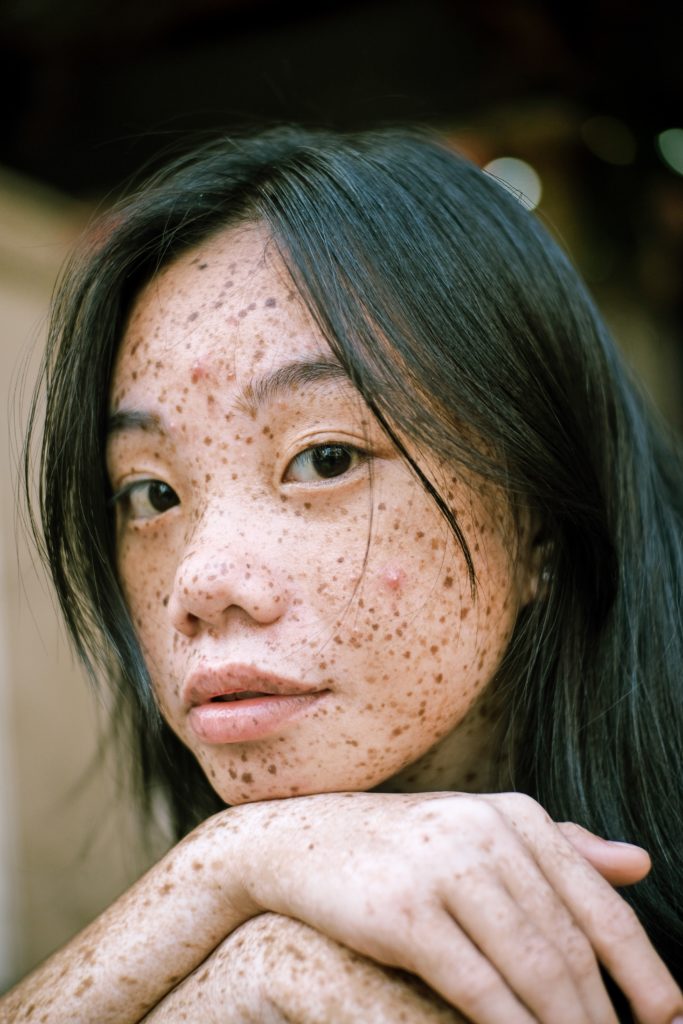 Young woman without makeup with freckles on face